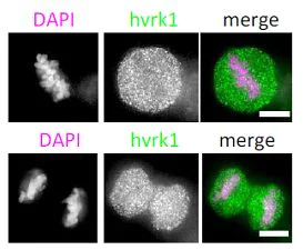 Immunocytochemistry/ Immunofluorescence - Anti-VRK1 antibody [5D1] - N-terminal (AB171933)