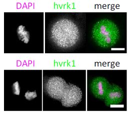 Immunocytochemistry/ Immunofluorescence - Anti-VRK1 antibody [5D1] - N-terminal (ab171933), expandable thumbnail