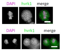 Immunocytochemistry/ Immunofluorescence - Anti-VRK1 antibody [5D1] - N-terminal (AB171933)