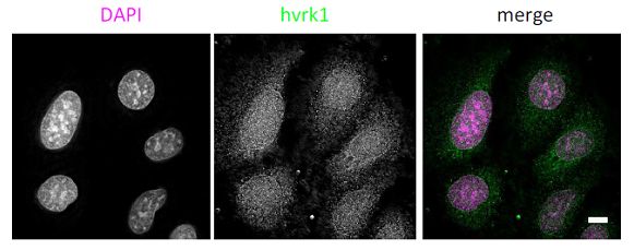 Immunocytochemistry/ Immunofluorescence - Anti-VRK1 antibody [5D1] - N-terminal (ab171933), expandable thumbnail