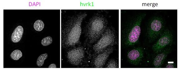 Immunocytochemistry/ Immunofluorescence - Anti-VRK1 antibody [5D1] - N-terminal (AB171933)