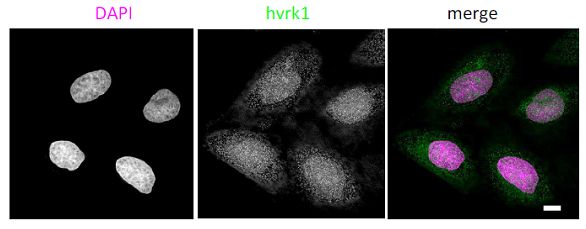 Immunocytochemistry/ Immunofluorescence - Anti-VRK1 antibody [5D1] - N-terminal (ab171933), expandable thumbnail