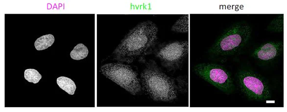 Immunocytochemistry/ Immunofluorescence - Anti-VRK1 antibody [5D1] - N-terminal (AB171933)