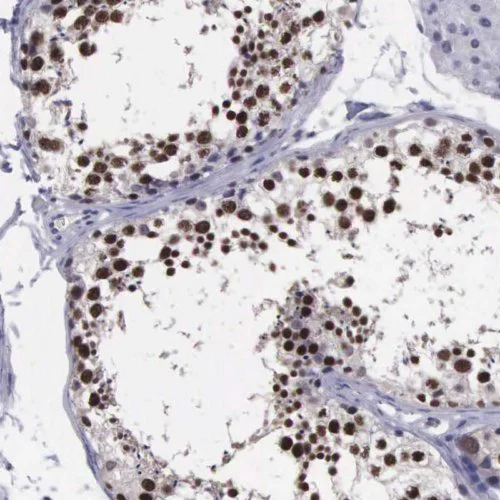 Immunohistochemistry (Formalin/PFA-fixed paraffin-embedded sections) - Anti-VRK1 antibody (AB211358)