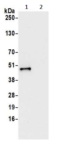 Immunoprecipitation - Anti-VRK1 antibody (AB241103)
