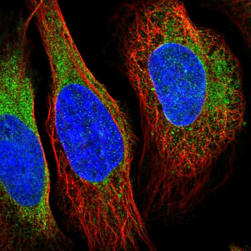 Immunocytochemistry - Anti-VRK2 antibody (AB184875), expandable thumbnail