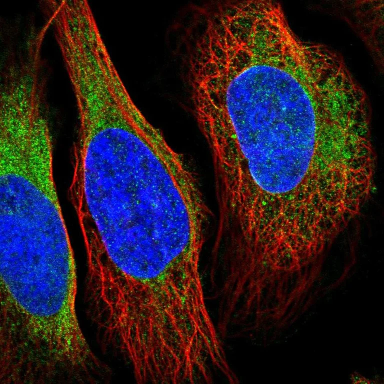 Immunocytochemistry - Anti-VRK2 antibody (AB184875)