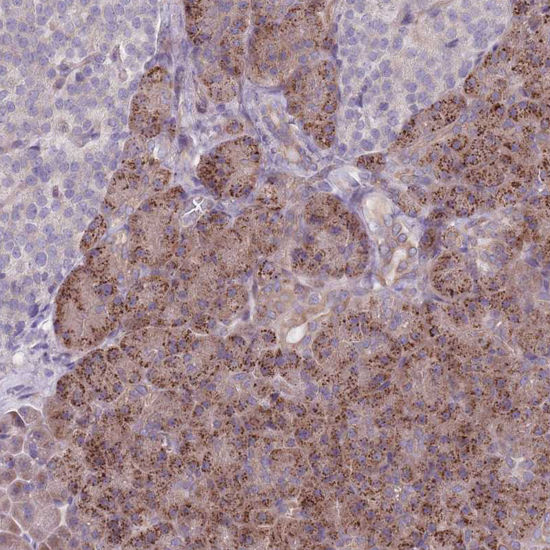 Immunohistochemistry (Formalin/PFA-fixed paraffin-embedded sections) - Anti-VRK2 antibody (AB184875), expandable thumbnail