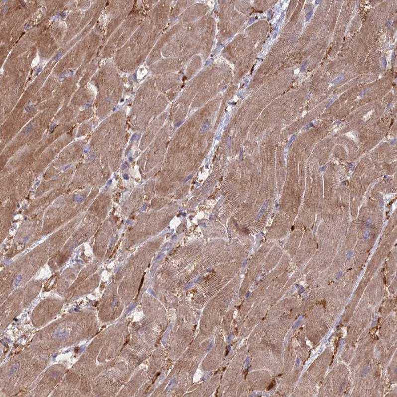 Immunohistochemistry (Formalin/PFA-fixed paraffin-embedded sections) - Anti-VRK2 antibody (AB184875), expandable thumbnail
