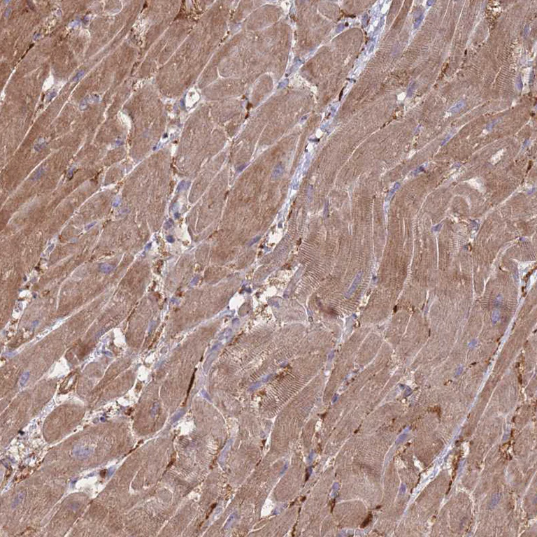 Immunohistochemistry (Formalin/PFA-fixed paraffin-embedded sections) - Anti-VRK2 antibody (AB184875)