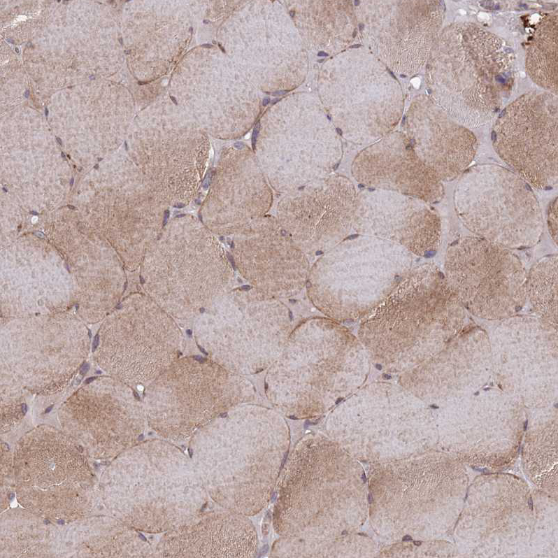 Immunohistochemistry (Formalin/PFA-fixed paraffin-embedded sections) - Anti-VRK2 antibody (AB184875), expandable thumbnail