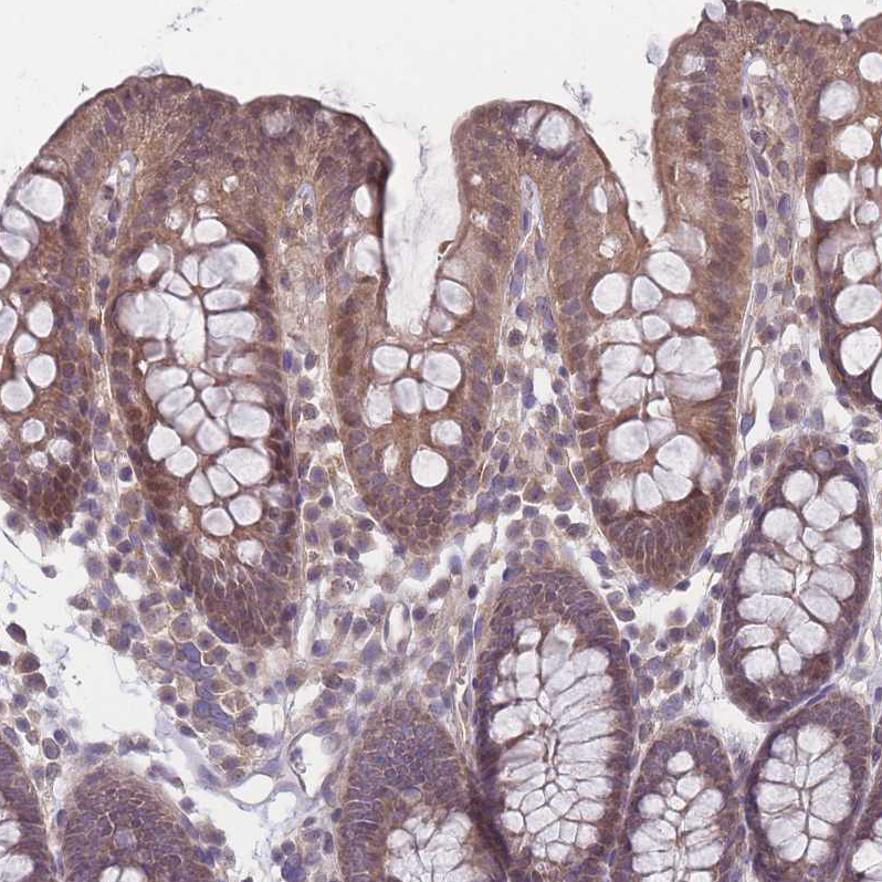 Immunohistochemistry (Formalin/PFA-fixed paraffin-embedded sections) - Anti-VRK2 antibody (AB184875), expandable thumbnail
