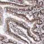 Immunohistochemistry (Formalin/PFA-fixed paraffin-embedded sections) - Anti-VRTN antibody (AB121138), expandable thumbnail
