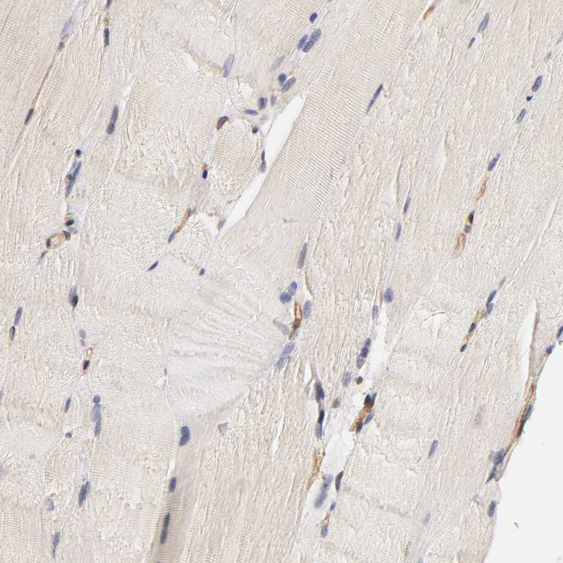 Immunohistochemistry (Formalin/PFA-fixed paraffin-embedded sections) - Anti-VSIG4 antibody (AB246869), expandable thumbnail