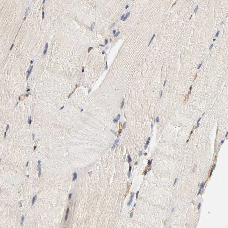 Immunohistochemistry (Formalin/PFA-fixed paraffin-embedded sections) - Anti-VSIG4 antibody (AB246869)