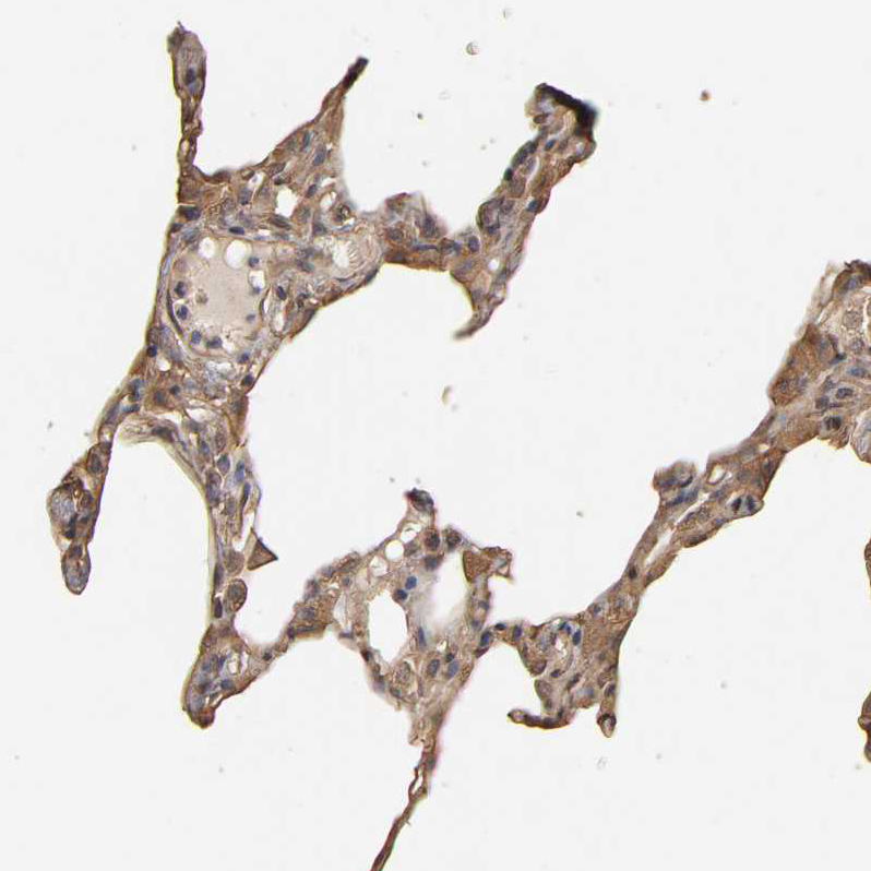 Immunohistochemistry (Formalin/PFA-fixed paraffin-embedded sections) - Anti-VSIG4 antibody (AB246869), expandable thumbnail