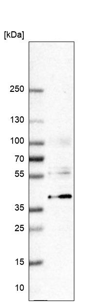 Western blot - Anti-VSIG4 antibody (AB246869), expandable thumbnail