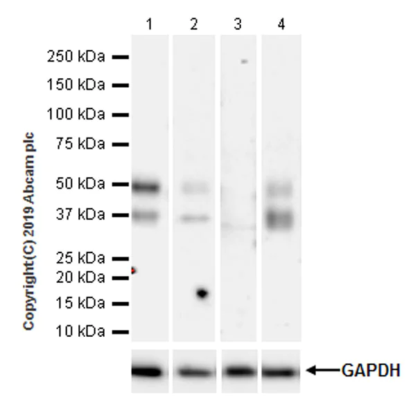 Western blot - Anti-VSIG4 antibody [EPR22576-125] (AB252932)