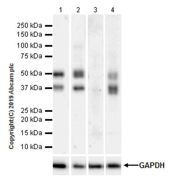 Western blot - Anti-VSIG4 antibody [EPR22576-70] (AB252933), expandable thumbnail