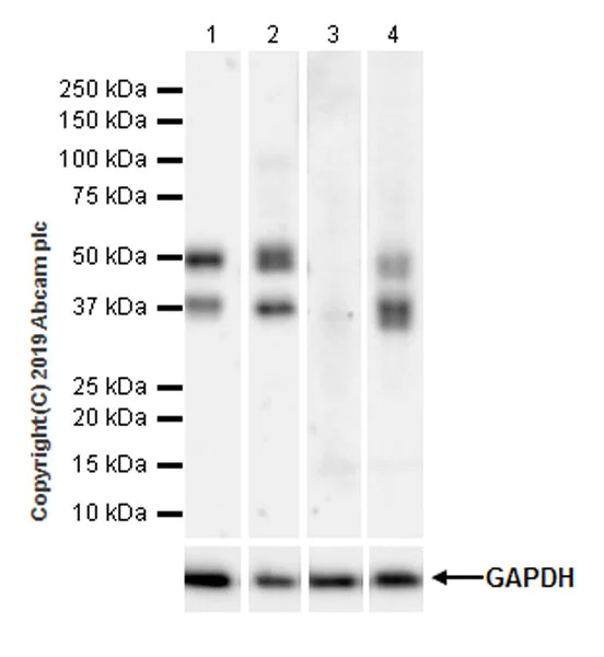 aminaseページ Engineering an Amine Transaminase for the Efficient
