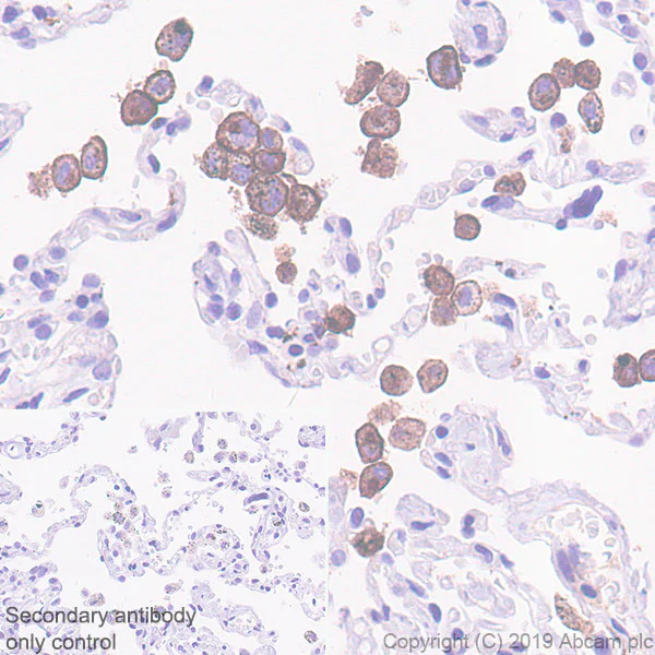 Immunohistochemistry (Formalin/PFA-fixed paraffin-embedded sections) - Anti-VSIG4 antibody [EPR22576-70] - BSA and Azide free (AB255692)