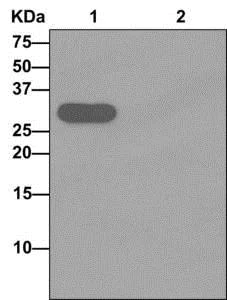 Immunoprecipitation - Anti-VSTM2B antibody [EPR10949] - BSA and Azide free (AB249803)