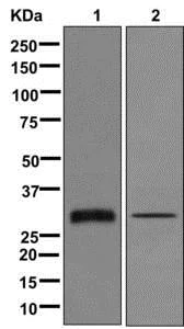 Western blot - Anti-VSTM2B antibody [EPR10949] - BSA and Azide free (AB249803)
