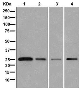 Western blot - Anti-VSTM5 antibody [EPR13131] (AB179816)