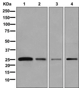 Western blot - Anti-VSTM5 antibody [EPR13131] - BSA and Azide free (AB250118)