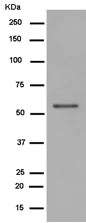 Western blot - Anti-VSV-G tag antibody [EPR12997] (AB183497)
