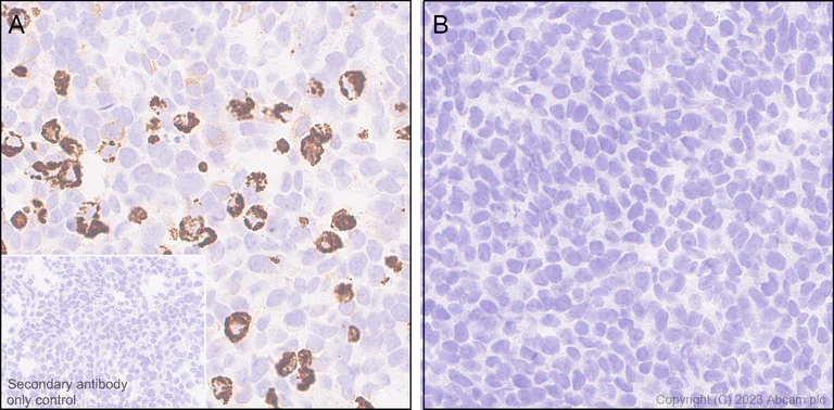 Immunohistochemistry (Formalin/PFA-fixed paraffin-embedded sections) - Anti-VSV-G tag antibody [EPR28362-204] - BSA and Azide free (AB309107)