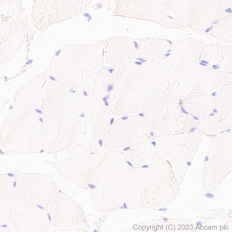 Immunohistochemistry (Formalin/PFA-fixed paraffin-embedded sections) - Anti-VSV-G tag antibody [EPR28362-204] - BSA and Azide free (AB309107)