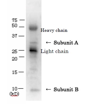 Immunoprecipitation - Anti-VT/Stx antibody (AB188542), expandable thumbnail