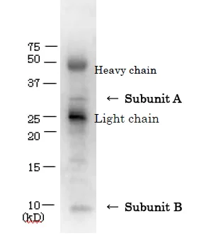 Immunoprecipitation - Anti-VT/Stx antibody (AB188542)