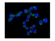 Immunocytochemistry/ Immunofluorescence - Anti-VTI1B antibody [EPR15506(B)] (AB184170)