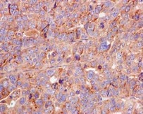 Immunohistochemistry (Formalin/PFA-fixed paraffin-embedded sections) - Anti-VTI1B antibody [EPR15506(B)] (AB184170), expandable thumbnail