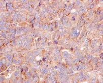 Immunohistochemistry (Formalin/PFA-fixed paraffin-embedded sections) - Anti-VTI1B antibody [EPR15506(B)] (AB184170)
