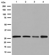 Western blot - Anti-VTI1B antibody [EPR15506(B)] (AB184170), expandable thumbnail