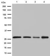 Western blot - Anti-VTI1B antibody [EPR15506(B)] (AB184170)