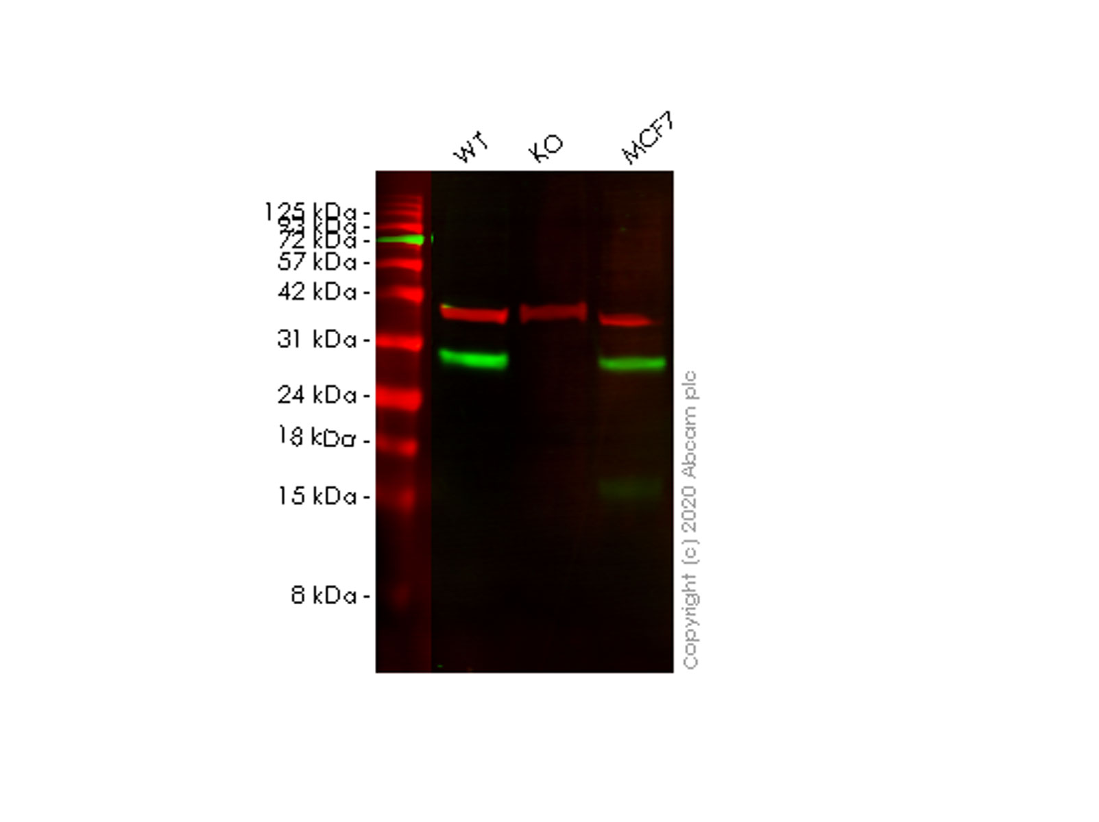 Western blot - Anti-VTI1B antibody [EPR15506(B)] (AB184170), expandable thumbnail