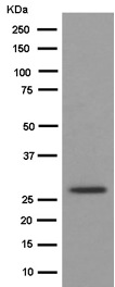 Western blot - Anti-VTI1B antibody [EPR15506(B)] (AB184170), expandable thumbnail