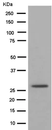 Western blot - Anti-VTI1B antibody [EPR15506(B)] (AB184170)