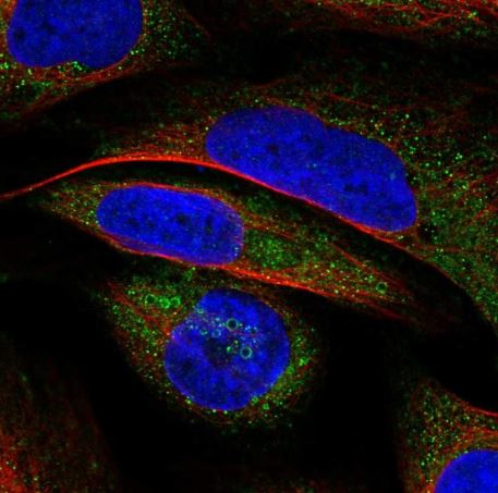 Immunocytochemistry/ Immunofluorescence - Anti-VWA8 antibody - C-terminal (AB184725)