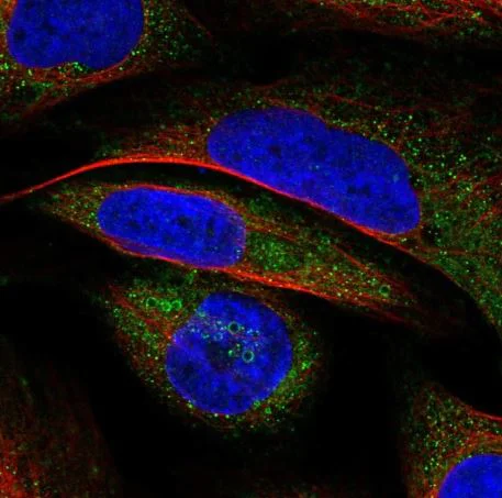 Immunocytochemistry/ Immunofluorescence - Anti-VWA8 antibody - C-terminal (AB184725)