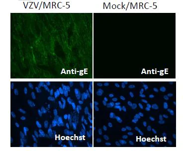 Immunocytochemistry/ Immunofluorescence - Anti-VZV gE protein antibody [#9] (AB272686)