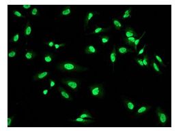 Immunocytochemistry/ Immunofluorescence - Anti-WAPL/FOE antibody [EPR3407(2)] (AB109537)