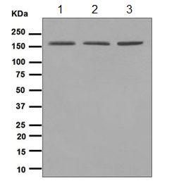 Anti-WAPL/FOE antibody [EPR3407(2)]