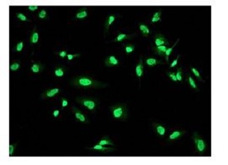 Immunocytochemistry/ Immunofluorescence - Anti-WAPL/FOE antibody [EPR3407(2)] - BSA and Azide free (AB232016)