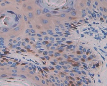 Immunohistochemistry (Formalin/PFA-fixed paraffin-embedded sections) - Anti-Warp antibody (AB231030), expandable thumbnail