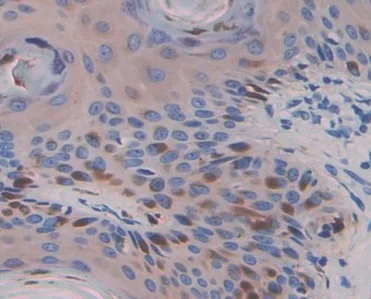 Immunohistochemistry (Formalin/PFA-fixed paraffin-embedded sections) - Anti-Warp antibody (AB231030)
